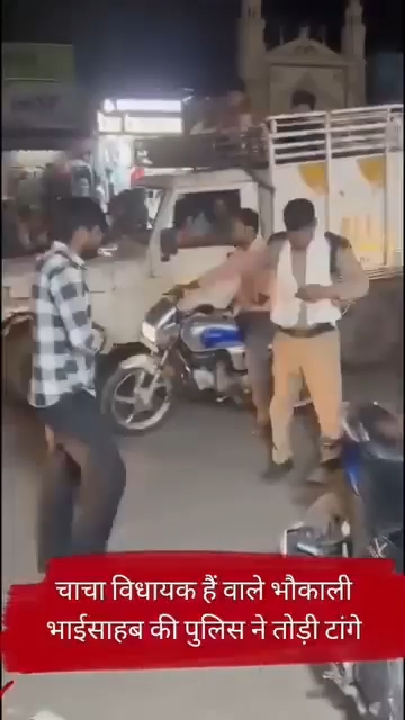 योगी के यूपी में गुंडों का इलाज: लखनऊ में होमगार्ड को पीटने वाले की टाँगें तोड़ीं