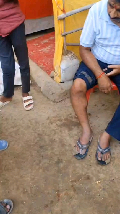 मैहर रोपवे मार्ग पर ठेकेदार की लापरवाही: दर्शनार्थी का पैर टूटा, सुरक्षा पर सवाल