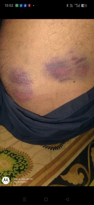 ब्याज के पैसे को लेकर मारपीट, थाने में तहरीर दर्ज